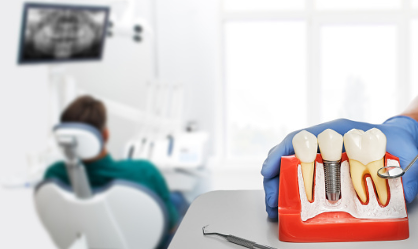 Dental Implant Surgery