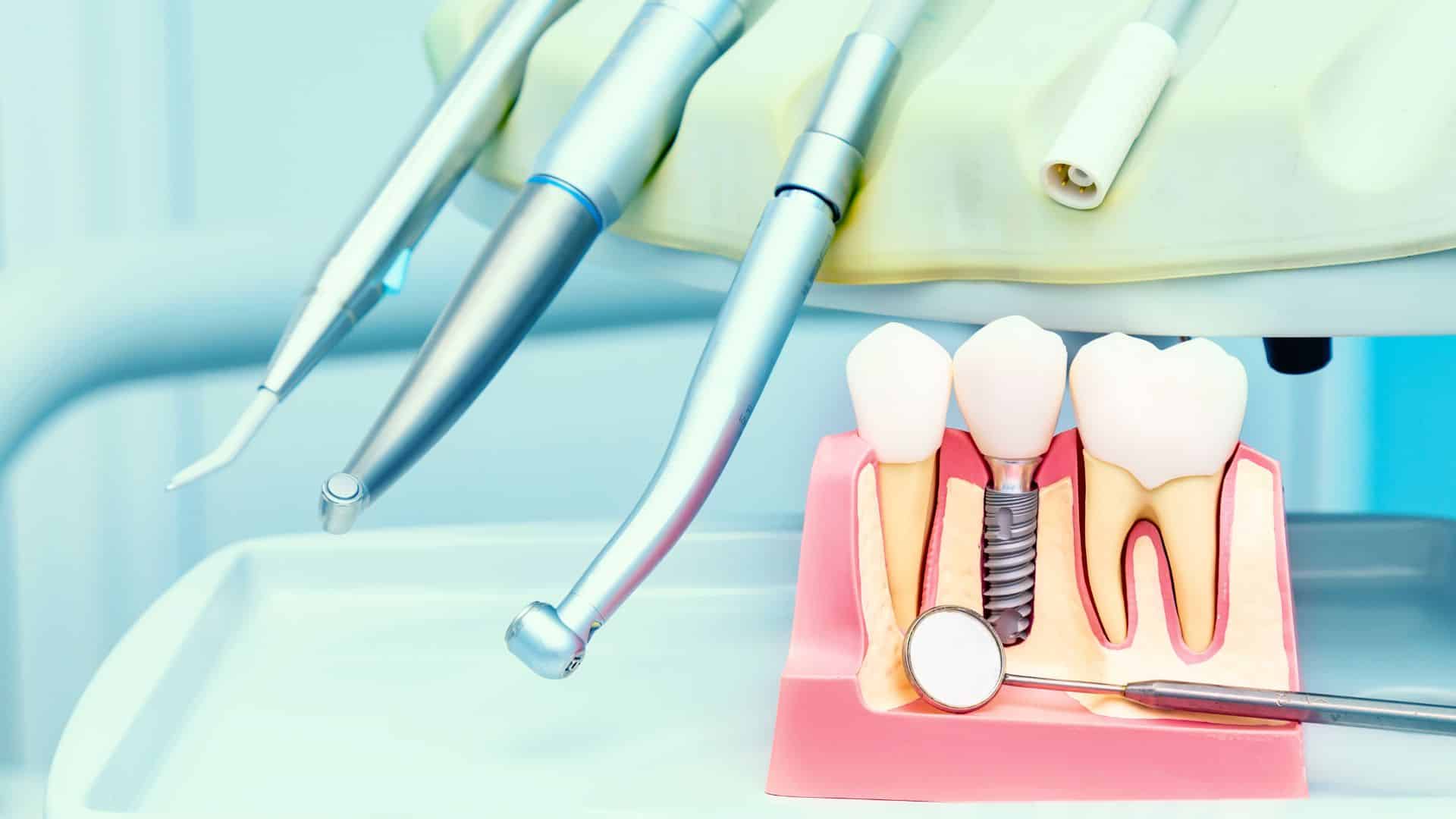 Dental Implants Portland OR