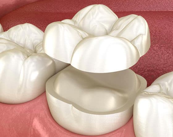 Cosmetic Dentistry in Portland