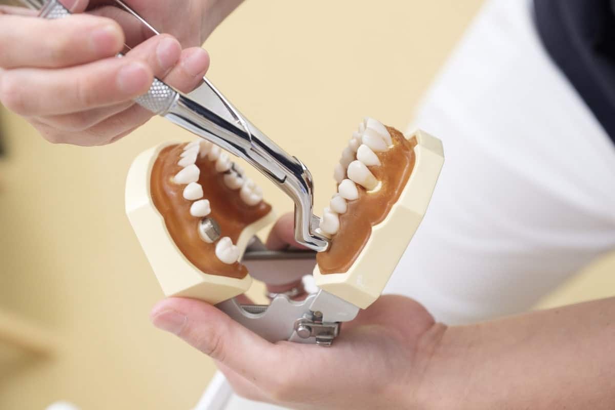 Is Tooth Extraction Safe for Heart Patients