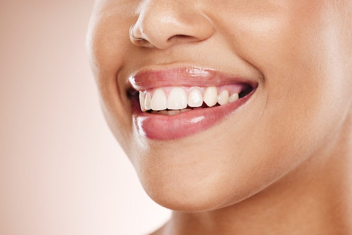 Featured image for “Natural vs. Cosmetic Dental Solutions: What’s Right for You?”