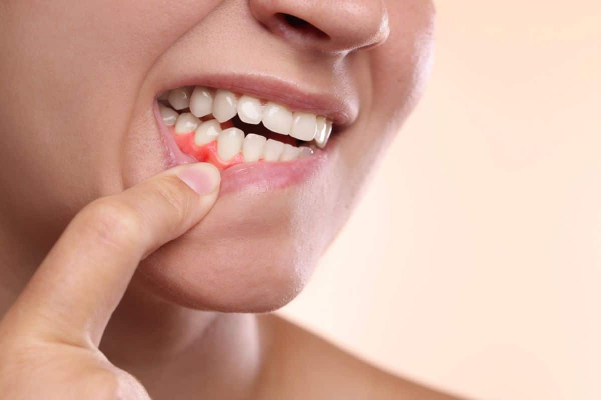 Can Gum Disease Really Make You Lose Your Teeth