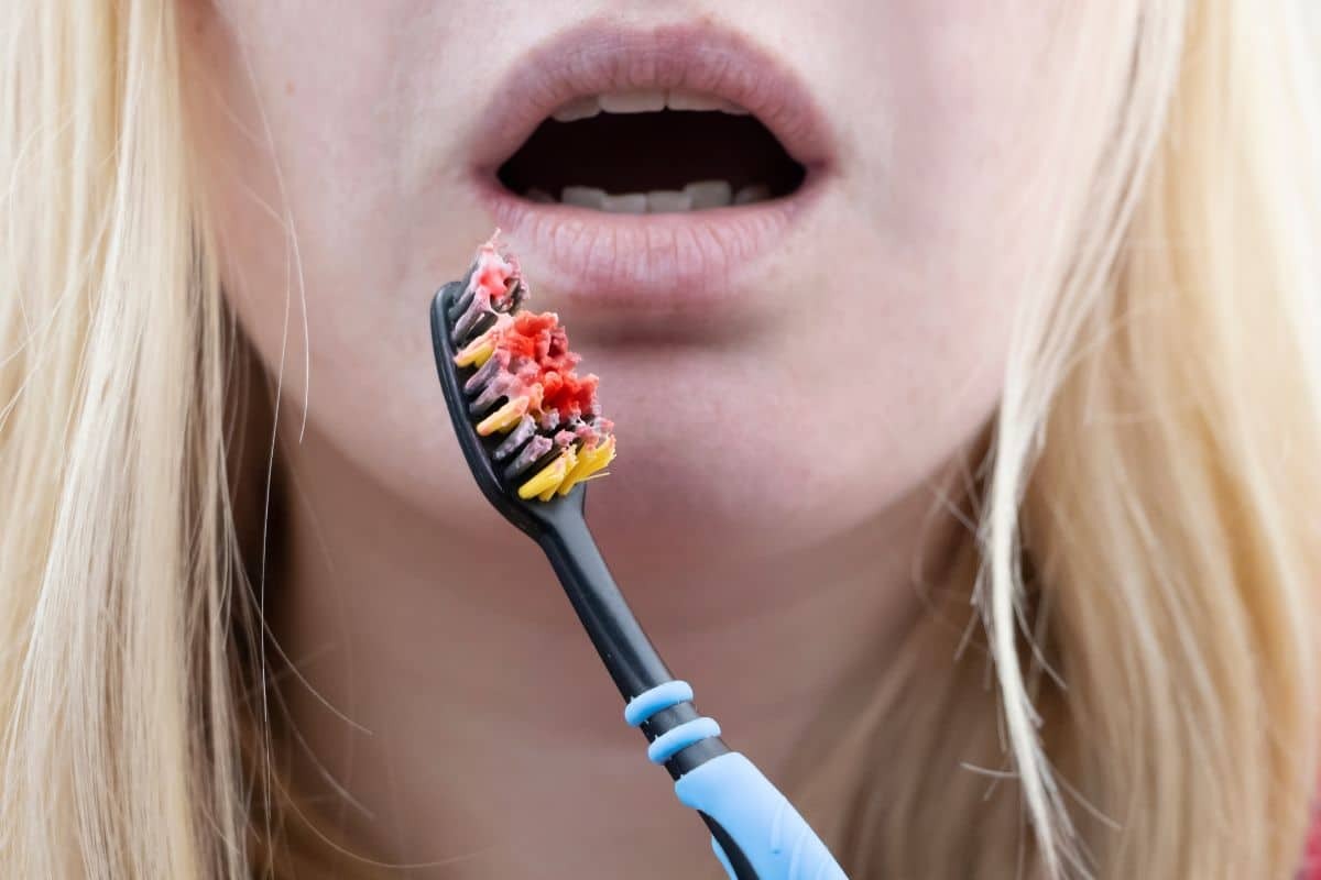 Featured image for “Why Are My Gums Bleeding When I Brush? Causes and When to See a Dentist”